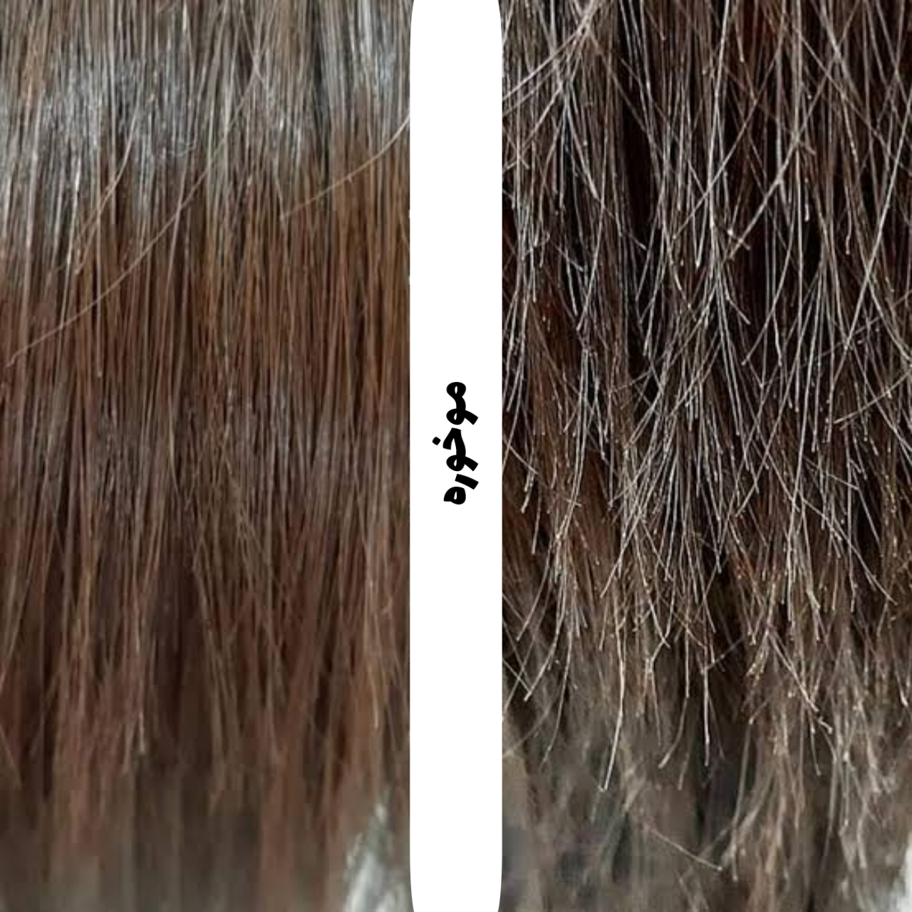 بهترین روغن گیاهی برای درمان موخوره چیه؟