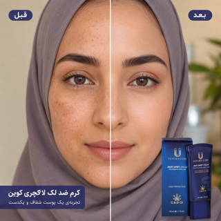 چند راهکار خانگی برای رفع لک صورت